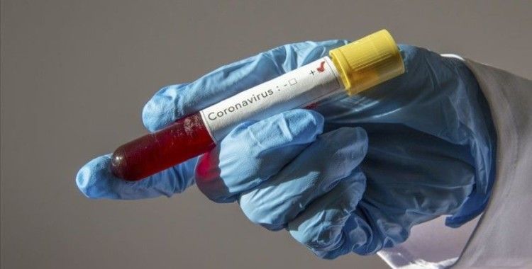 İran'da günlük koronavirüs ölüm sayısında yeni rekor