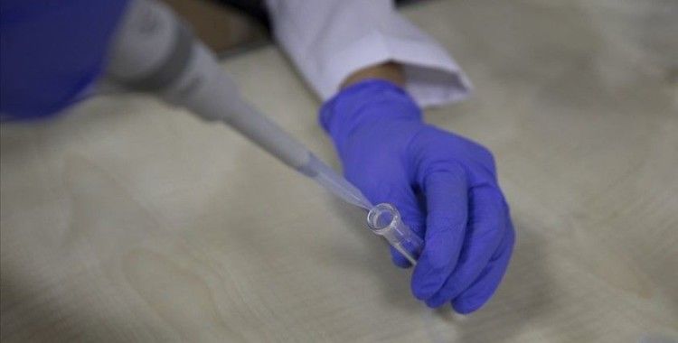 Brezilya'da Oxford'un geliştirdiği Kovid-19 aşısı deneylerine katılan bir gönüllü doktor öldü