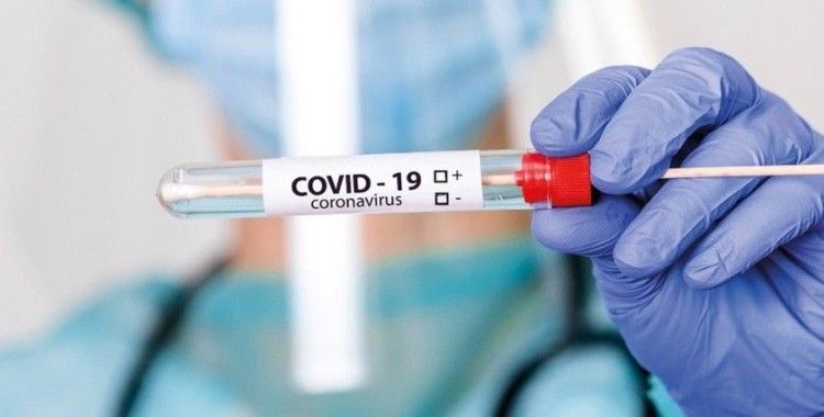 Ukrayna: 'Koronavirüs aşısının bize maliyeti 14 dolar'
