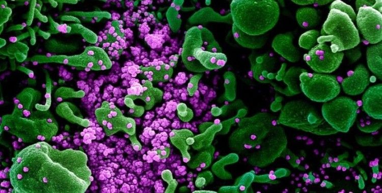 Kaliforniaya'da kırmızı alarm: Bir koronavirüs varyantı daha tespit edildi