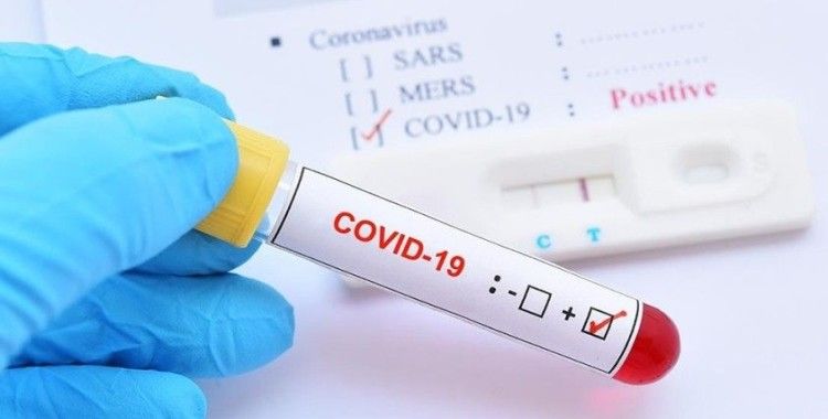 Koronavirüs salgınında vaka sayısı 108 milyon oldu