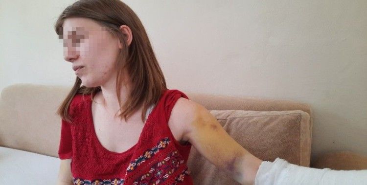 Beyzbol sopasıyla öldüresiye dövülen genç kadın: "Öleceğimi sandım"
