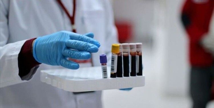 Polonya'da Covid-19 hastası 3 kişide NDM-1 bakterisi tespit edildi