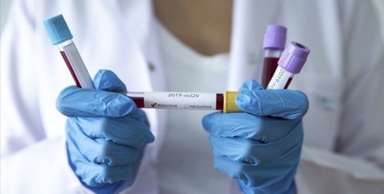 Almanya'da son 24 saatte koronavirüsten 265 kişi öldü