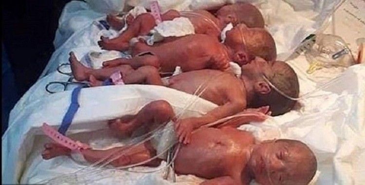 Malili kadın 9 bebek dünyaya getirdi