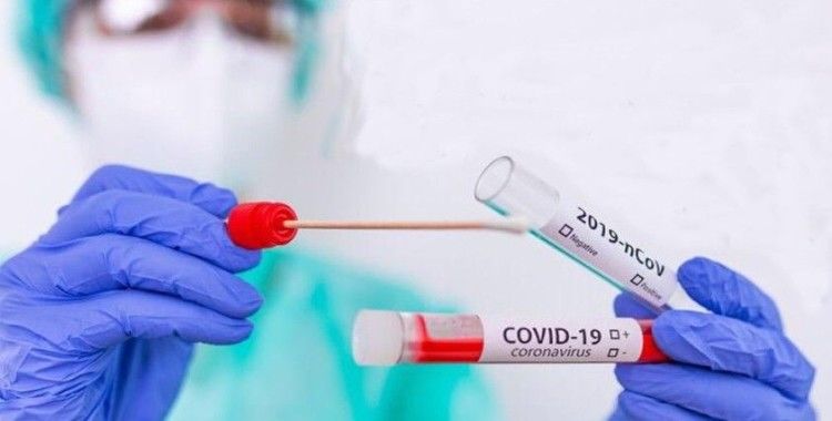 Covid-19 aşısı olmayan işçilerden, zorunlu olarak haftada bir kez PCR testi yaptırmaları istenebilecek