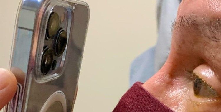 ABD'li doktor, göz tedavisi için iPhone 13 Pro Max kullanıyor