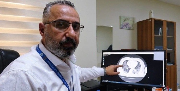 Aşısız hastaların akciğer tomografisini paylaşarak uyardı