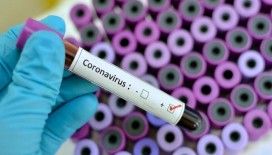 Son 24 saatte koronavirüsten 246 kişi hayatını kaybetti