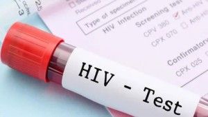 1,5 milyon yeni HIV vakası dünyayı tehdit ediyor