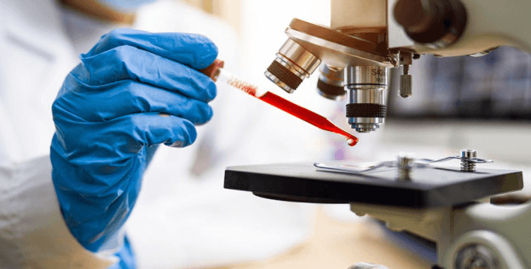 İngiltere'de yapılan kan testi, her üç kanserden ikisini tespit edebildi