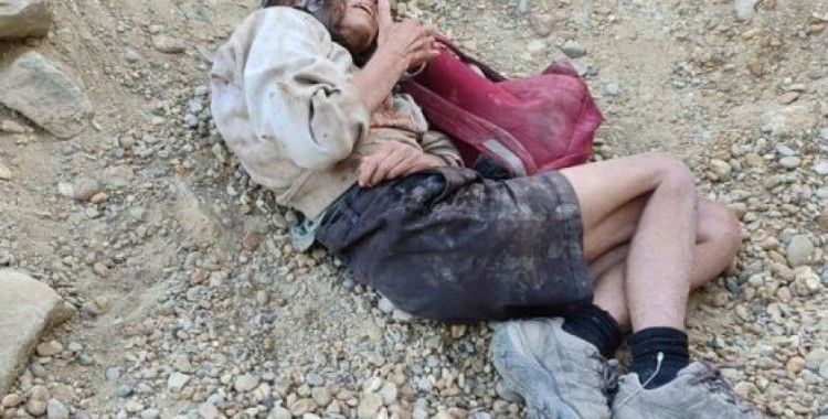 Fransız gezgin kadının vücudunda kırıklar var: Bilinci kapalı yoğun bakımda