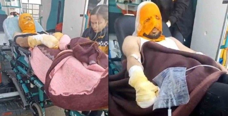 Erzincan’da trafo patlaması sonucu 2 Aras Edaş personeli yaralandı
