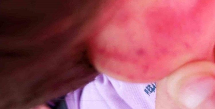 Otizmli çocuğunu darp ettiği iddia edilen babaya hapis cezası
