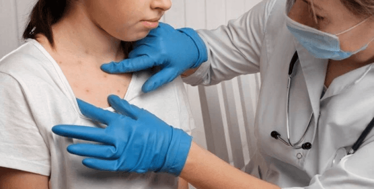 DSÖ'den Avrupa'da kızamık uyarısı: 2024'te 27 yıl sonra en yüksek vaka görüldü