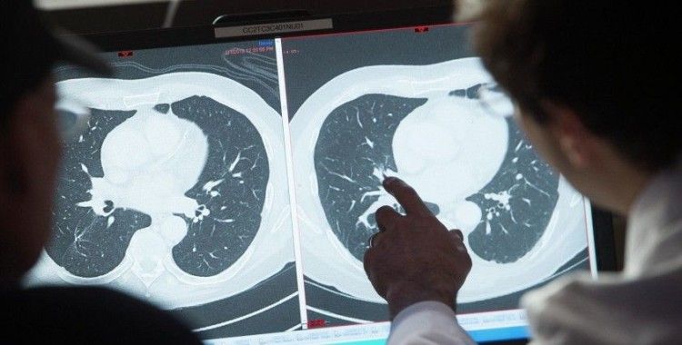 Ulusal Kanser Haftası'nda ücretsiz kanser taramalarını başladı: Ücretsiz tarama testleri nerelerde yapılıyor?