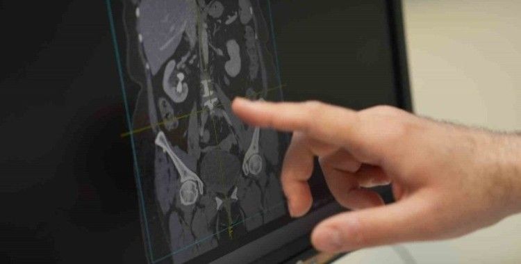 "Erkek sağlığının sırrı sofrada: Beslenmeyle cinsel gücü artırın"
