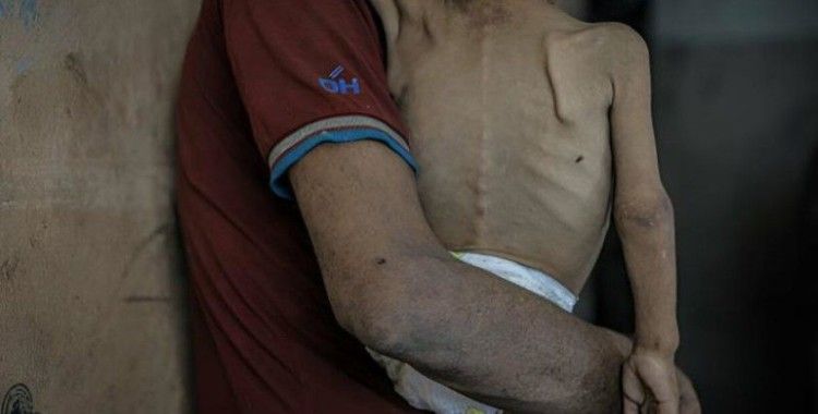 UNRWA Genel Komiseri: Gazze’de açlık herkesi yavaş ve sessiz bir ölüme mahkum etti
