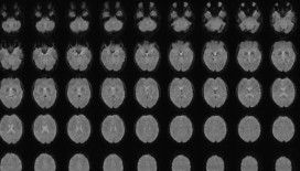 Zihin okuma artık mümkün mü? Japonlardan yeni keşif