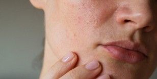 Bilim insanları insan hücrelerini 30 yıl gençleştirmeyi başardı