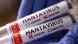Sağlık Bakanlığı'ndan "hantavirüs" açıklaması