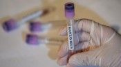 DSÖ: Hantavirüs yeni bir pandemi başlangıcı değil